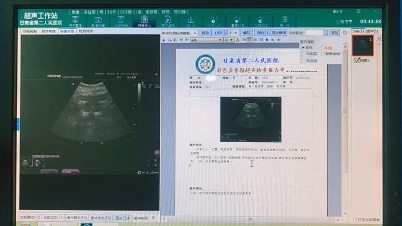 高端体检机构品牌探秘：揭秘高品质健康守护之道